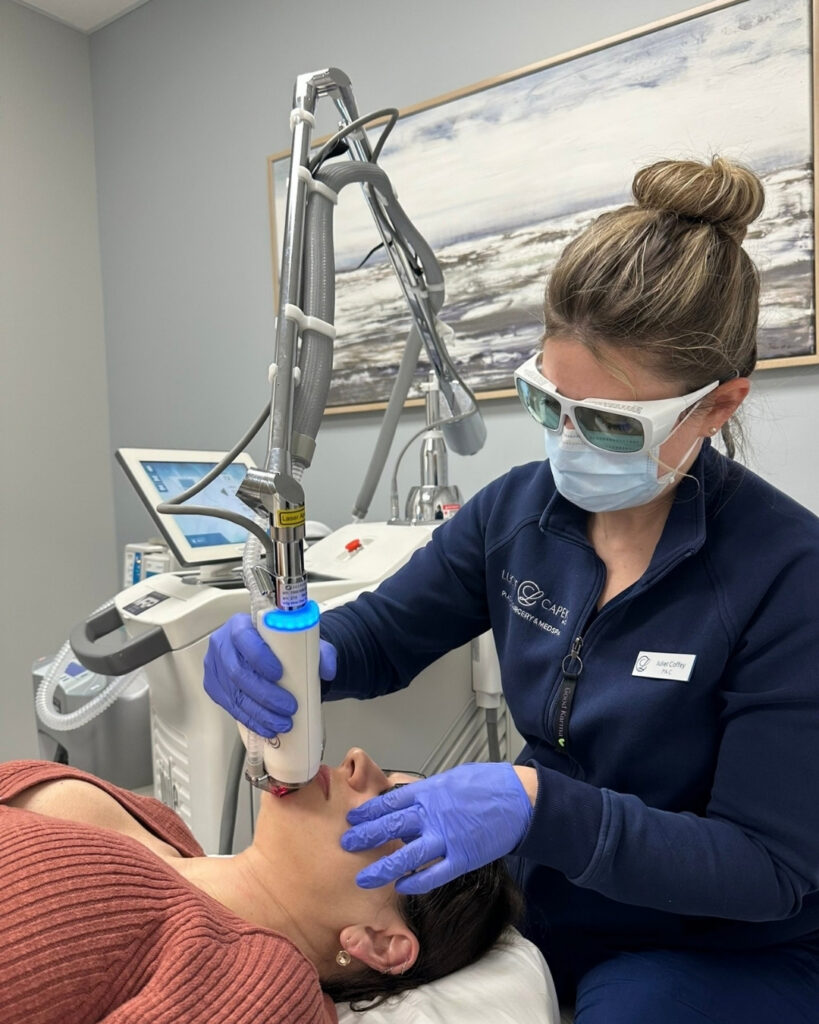 Juliet Coffey, PA-C, performs Hybrid Fractional Laser treatment in her navy blue scrubs on a dark-haired patient in a dusty rose shirt.