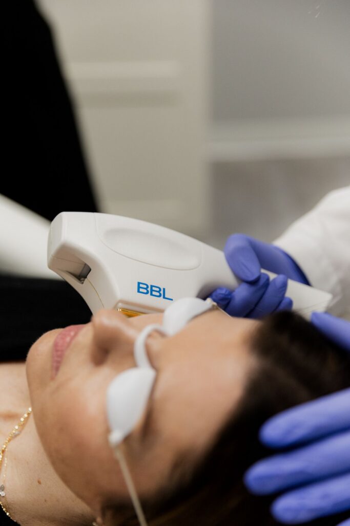 A dark haired patient with eye protection receiving a BBL laser treatment. The white handheld device is pictured.